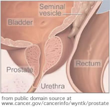 prostata psa wert 14